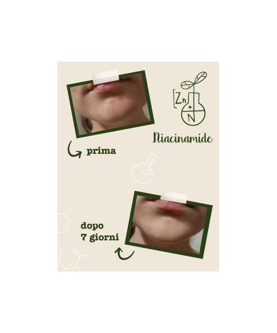 LA SAPONARIA Attivi Puri Niacinamide + Zinco