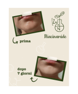 LA SAPONARIA Attivi Puri Niacinamide + Zinco