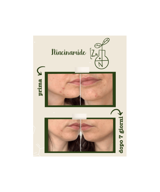 LA SAPONARIA Attivi Puri Niacinamide + Zinco