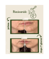 LA SAPONARIA Attivi Puri Niacinamide + Zinco
