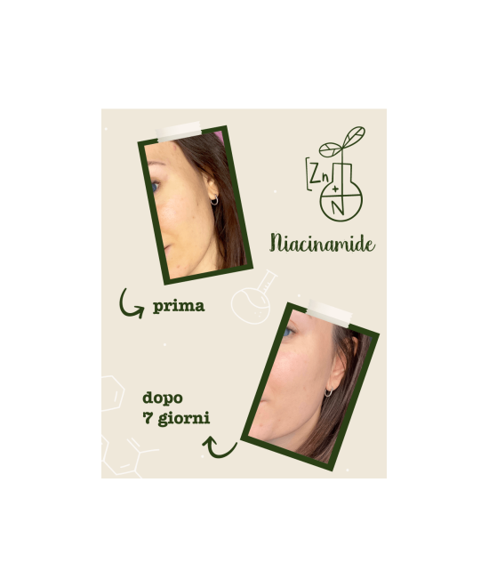 LA SAPONARIA Attivi Puri Niacinamide + Zinco