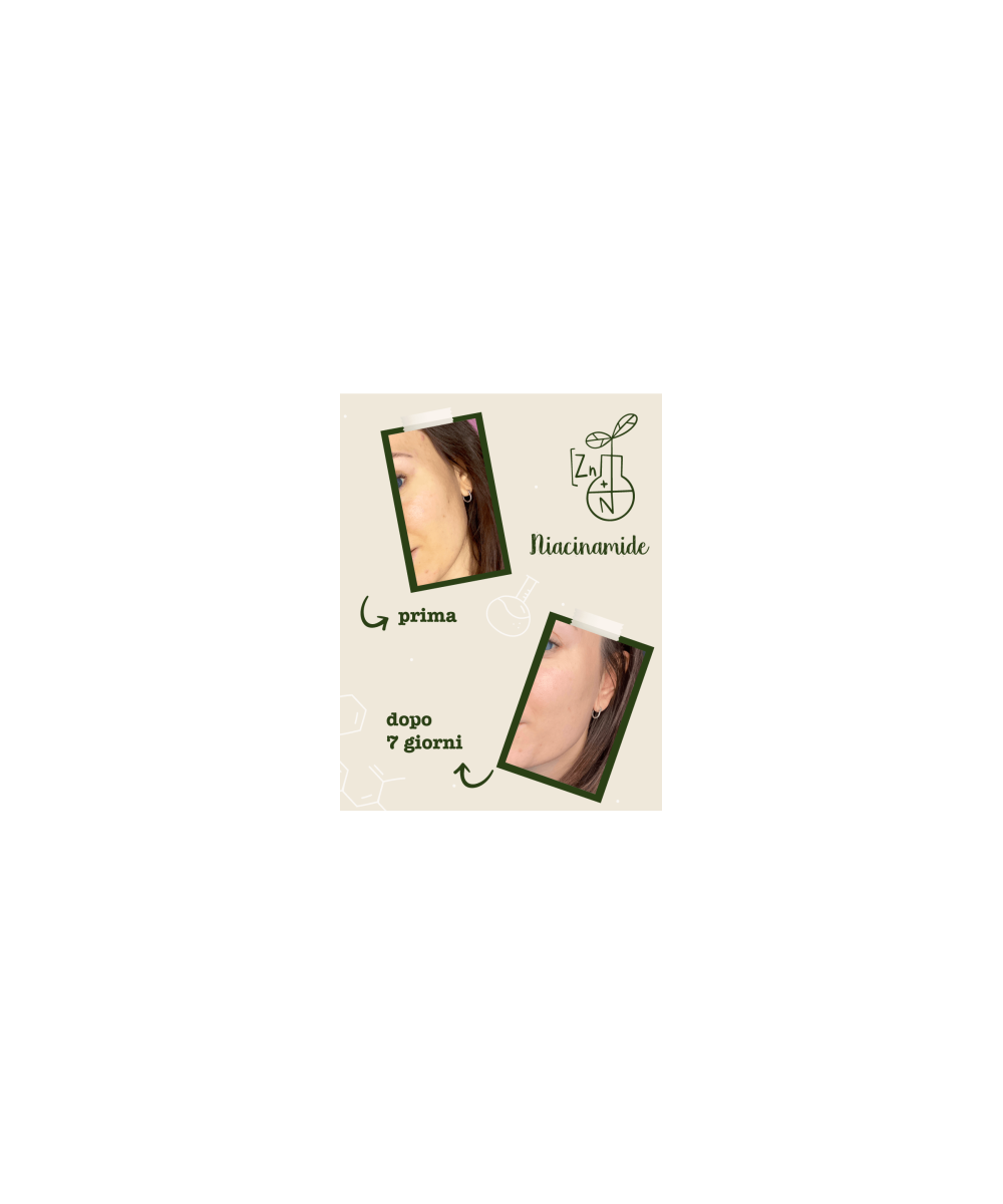 LA SAPONARIA Attivi Puri Niacinamide + Zinco