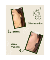 LA SAPONARIA Attivi Puri Niacinamide + Zinco