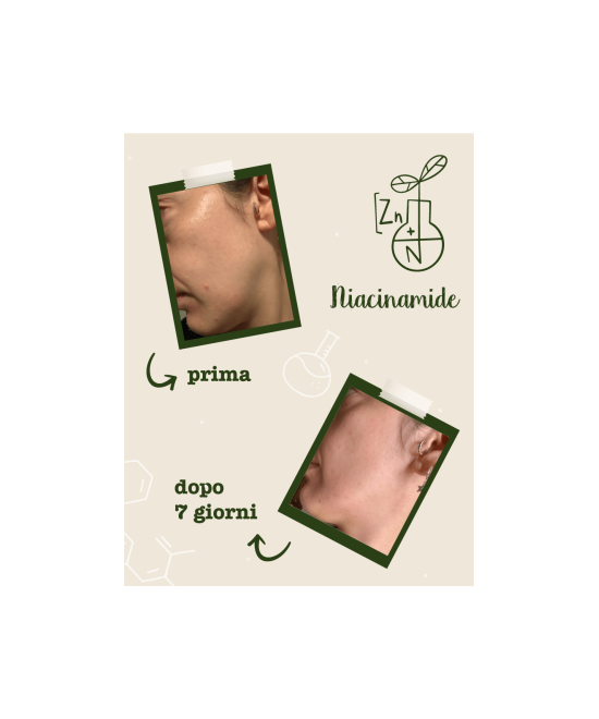 LA SAPONARIA Attivi Puri Niacinamide + Zinco