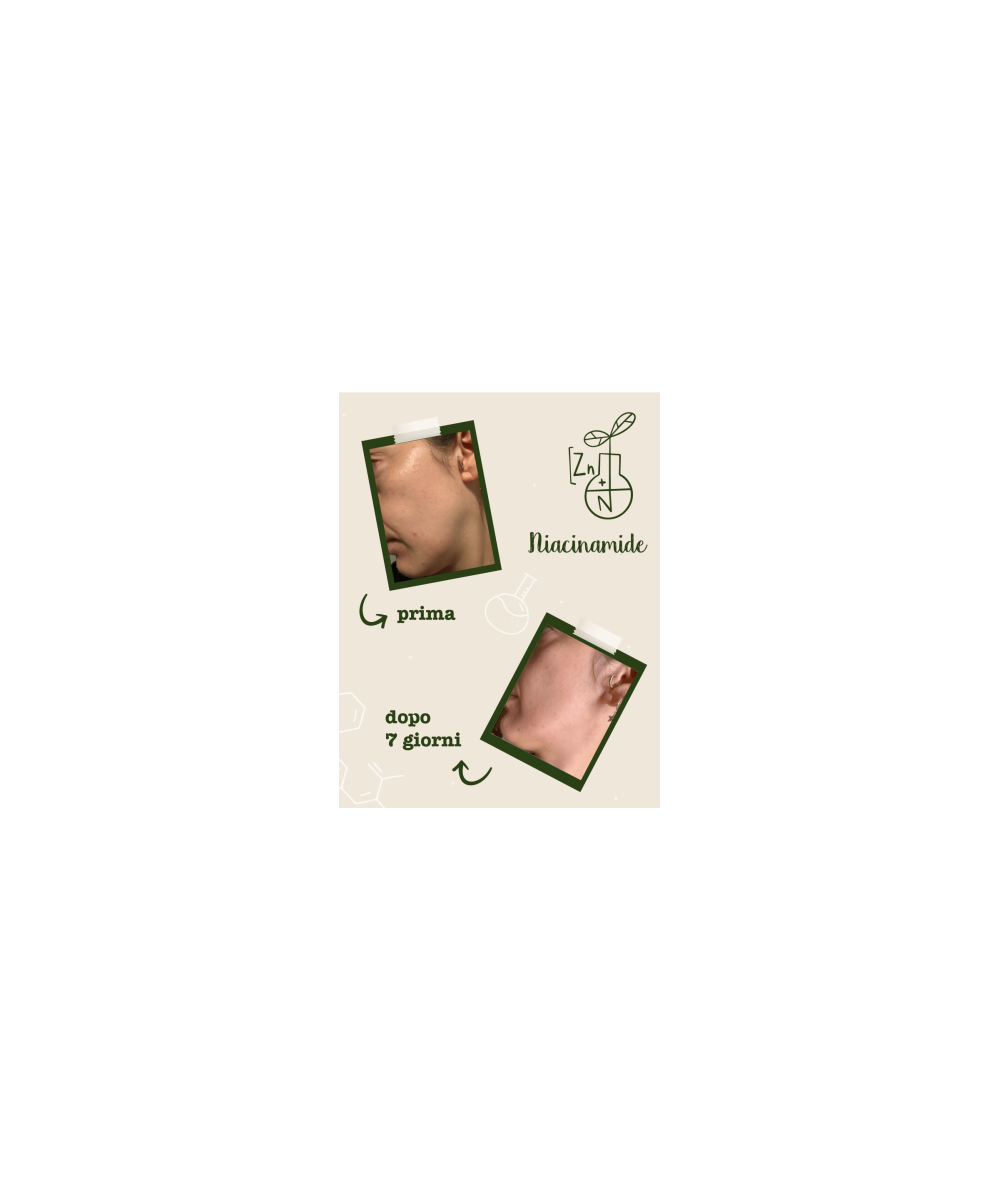 LA SAPONARIA Attivi Puri Niacinamide + Zinco