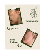 LA SAPONARIA Attivi Puri Niacinamide + Zinco